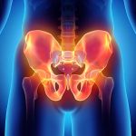 Fysiotherapie_de_Oversteek_heuppijn-bekkenpijn